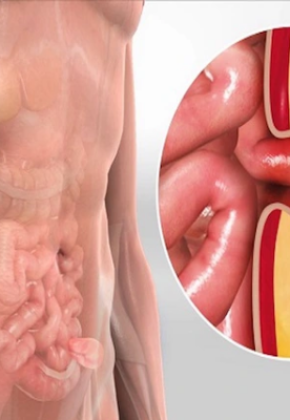 Điều trị, phẫu thuật các bệnh lý về gan, lách