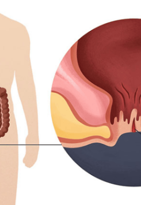 Điều trị, phẫu thuật các bệnh lý về gan, lách