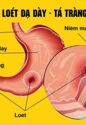 Điều trị, phẫu thuật các bệnh lý về gan, lách