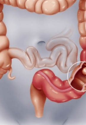 Điều trị, phẫu thuật các bệnh lý về gan, lách