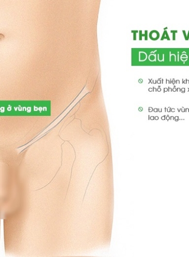 Dấu hiệu nhận biết sớm thoát vị bẹn và khi nào cần phẫu thuật?