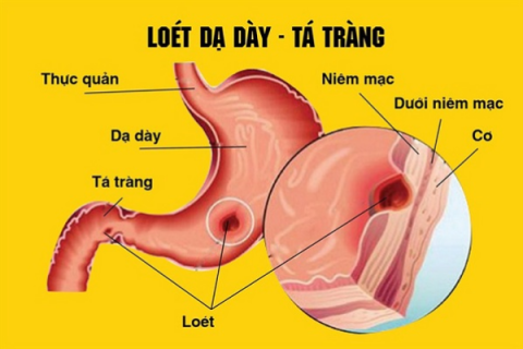 Các bệnh lý đường tiêu hóa